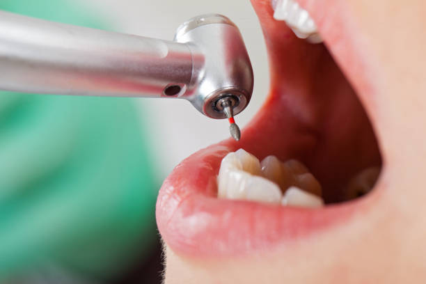 Best Emergency Dentist for Knocked-Out Tooth in Ridge Wood Heights, FL